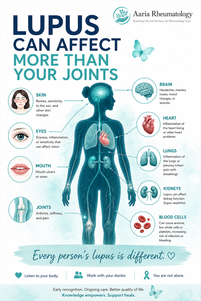 Lupus as a systemic autoimmune disease affecting multiple organs