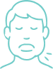Angioedema