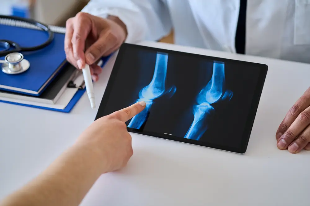 A patient consulting a rheumatologist regarding joint inflammation.