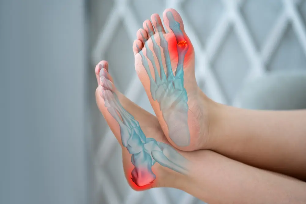 Joint pain at feet area