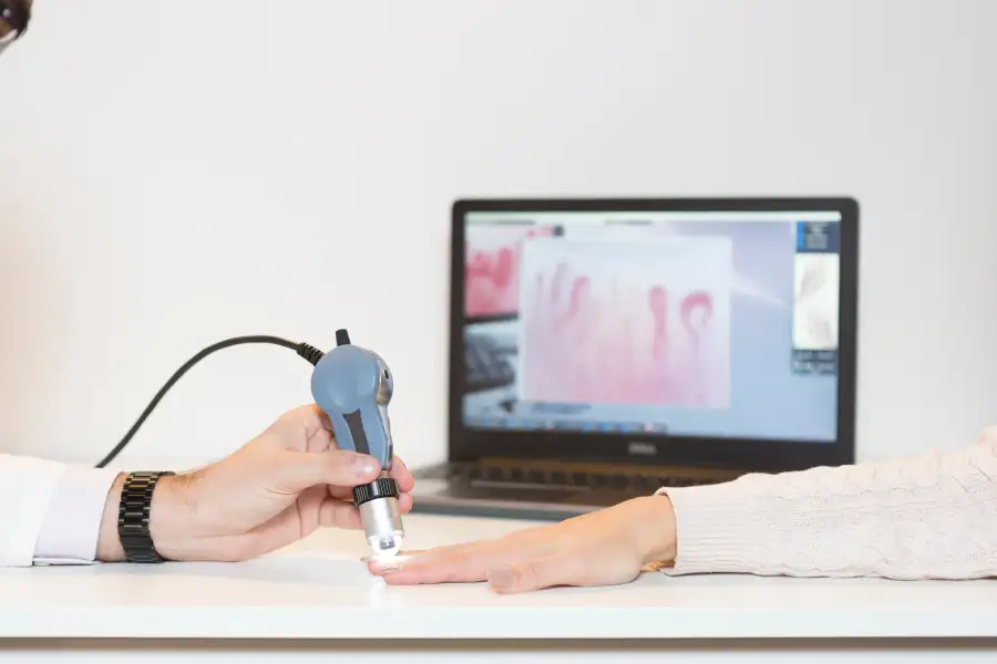 What is Nailfold Capillaroscopy?