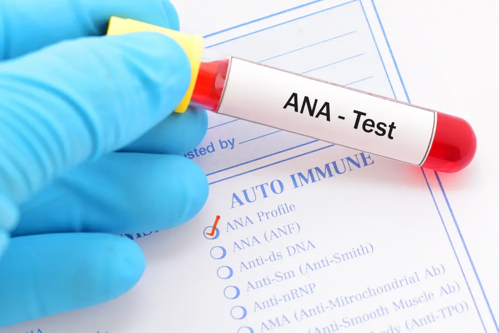 A blood sample labeled ANA Test over a form.