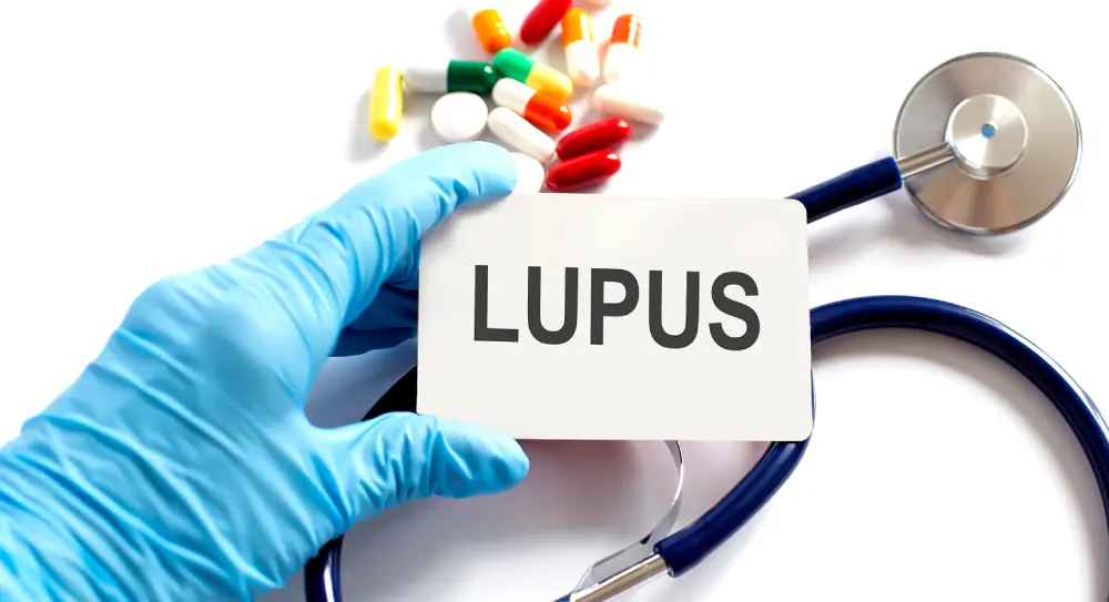 Gloved hand holding card reading Lupus near stethoscope, pills.