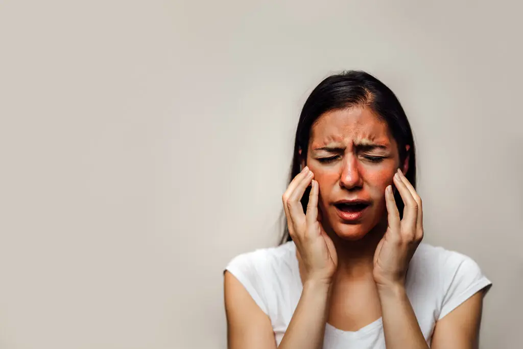 A woman suffering from lupus flares
