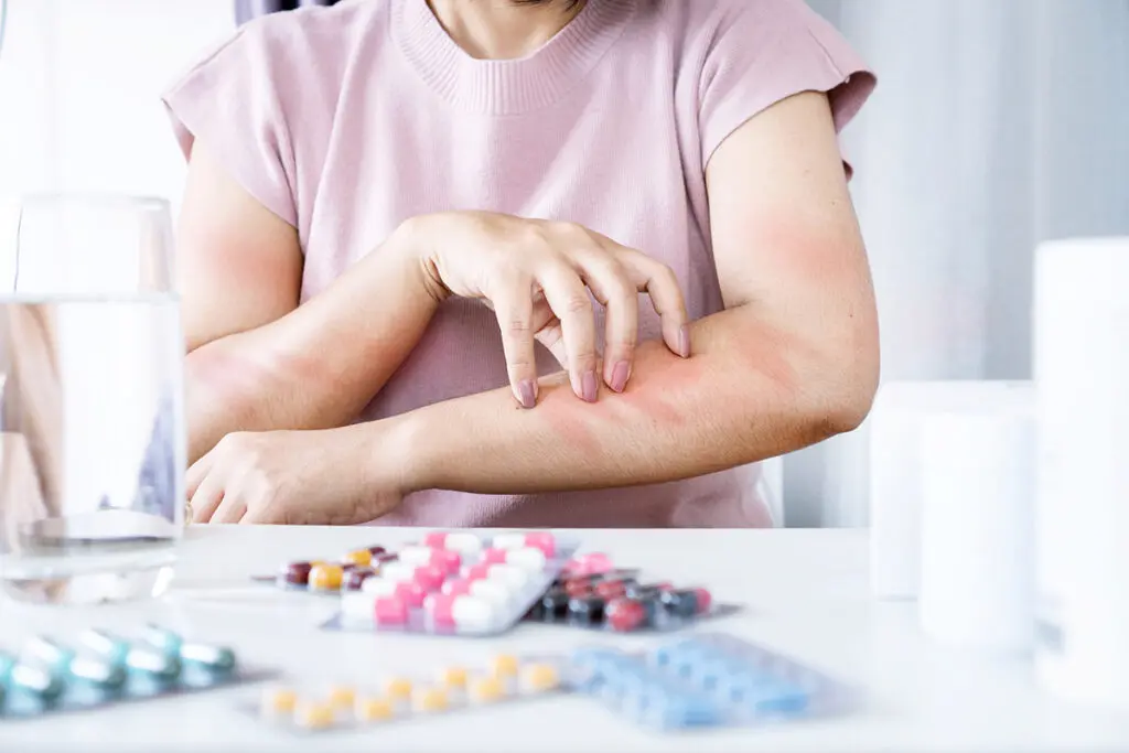 A woman experiencing drug allergies