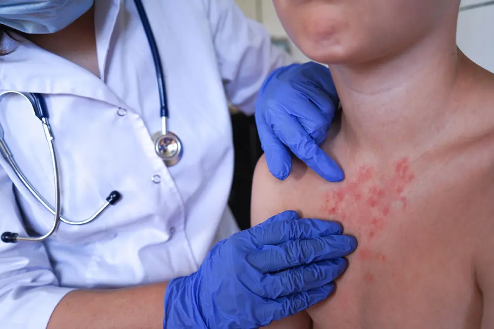 A doctor assessing a patient’s drug allergies