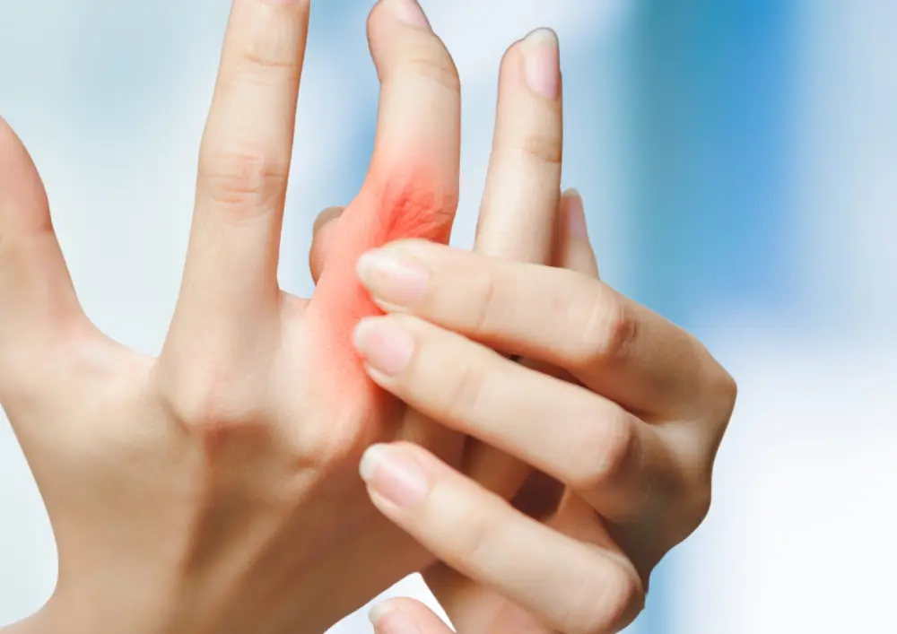 A person holding their red, painful finger joint.